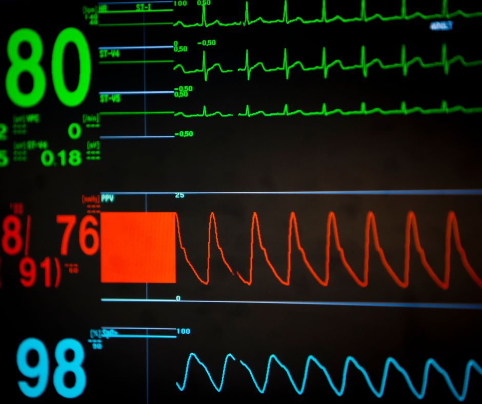 screen image of patient's vital signs